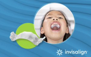 3D printed Invisalign Palatal Expander for kids in Penang