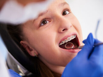 dentist helps a little girl to wear braces