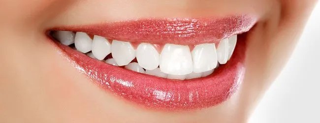 gigi putih