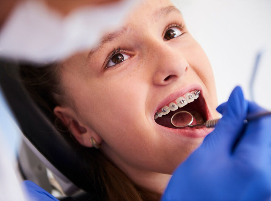 dentist helps a little girl to wear braces