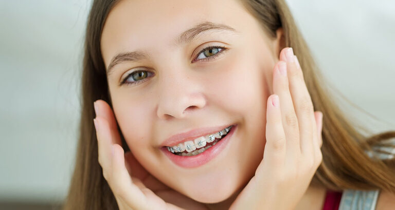 teeth retainers
