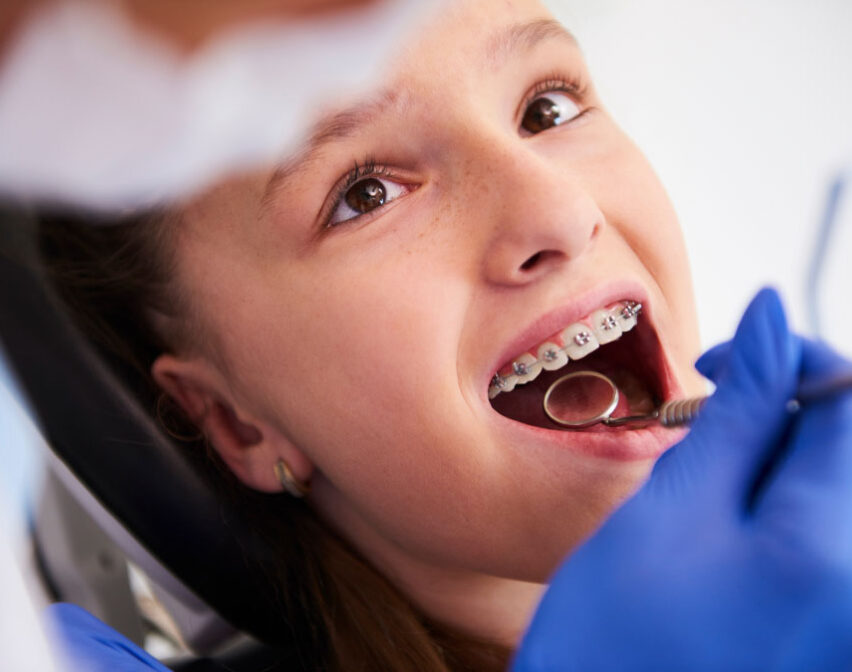 Braces, Invisalign & Myobrace Skye Dental Penang