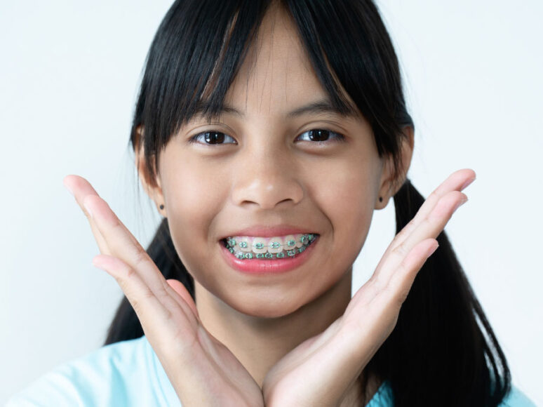 Braces, Invisalign & Myobrace Skye Dental Penang